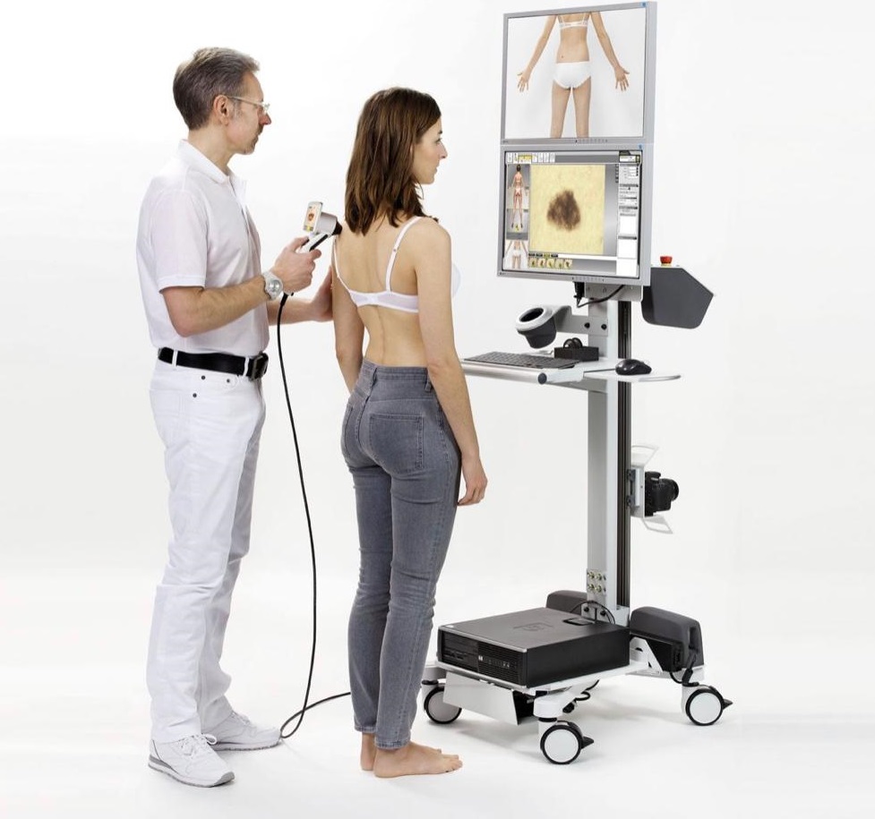 videodermatoskopia badanie zmian skórnych wrocław