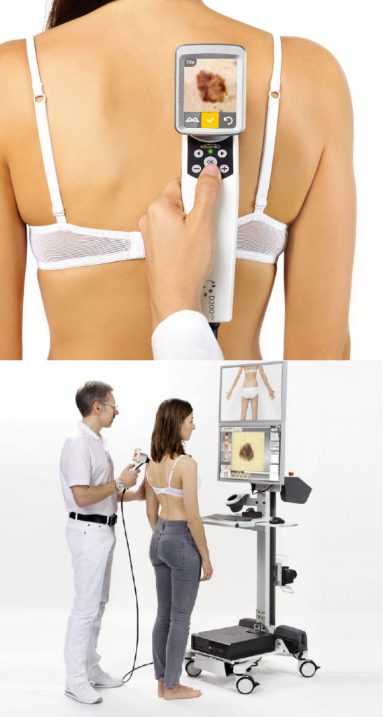 videodermatoskop wrocław badanie zmian skórnych