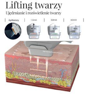 ultraformer 3 na twarz