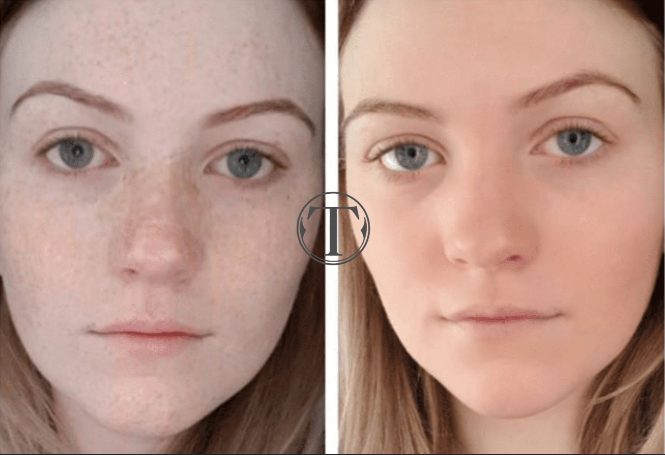 <br />
<b>Notice</b>: Undefined variable: header in <b>/home/platne/like08/public_html/tesoroclinic.pl/wp-content/themes/like-v4.1/template-parts/content-page.php</b> on line <b>321</b><br />