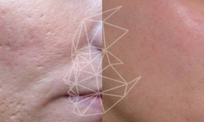 fraksel-05-mwfax75btwvypbsj57ez3g9ncf5sa6dx4o8ru4yn58